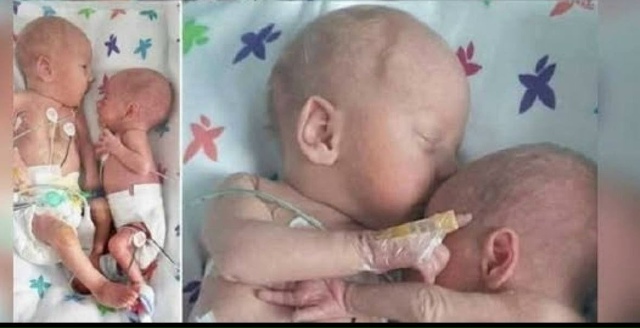 Медсестра положила здорового ребёнка рядом
с его умир...