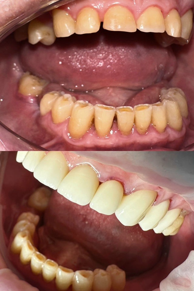 СТОМАТОЛОГИЯ Эмидент 📲 8-800-555-73-67 • nfk.emident.ru
🏠 Нефтека...