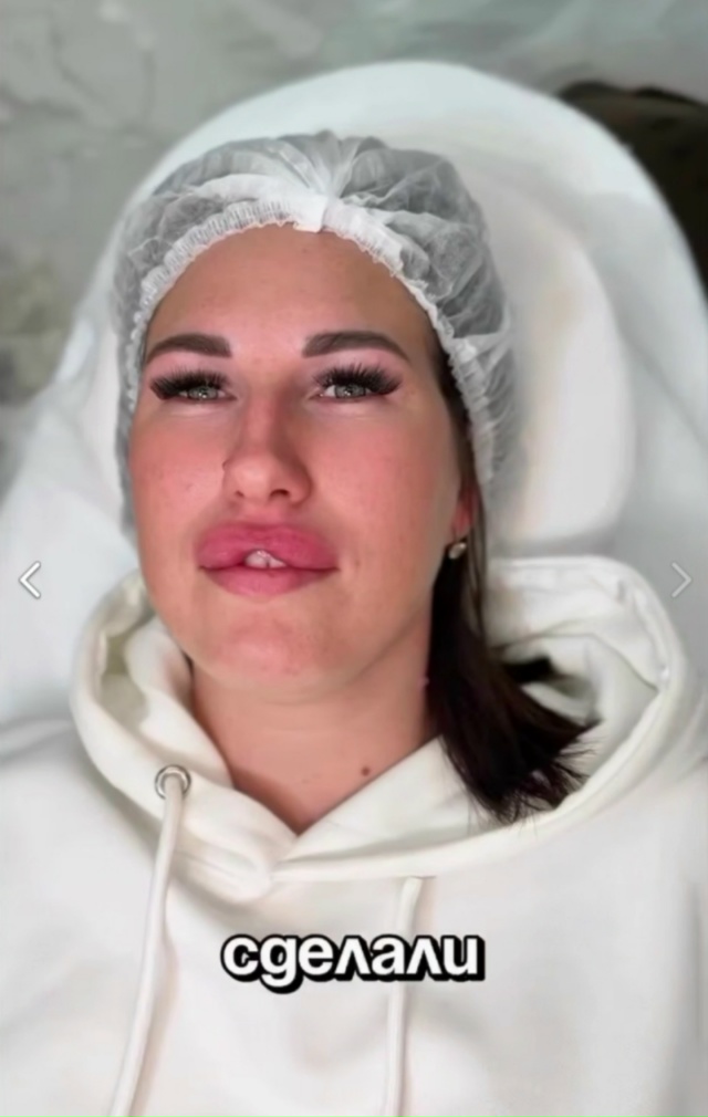 💋 Стремительно растёт спрос на инъекционное увеличен...