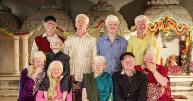 Самая большая семья альбиносов в мире проживает в Инди...