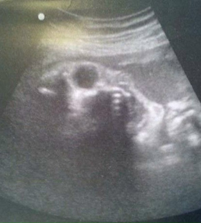 9 лет работаю узисткой в больнице. И иногда даже мне стр...