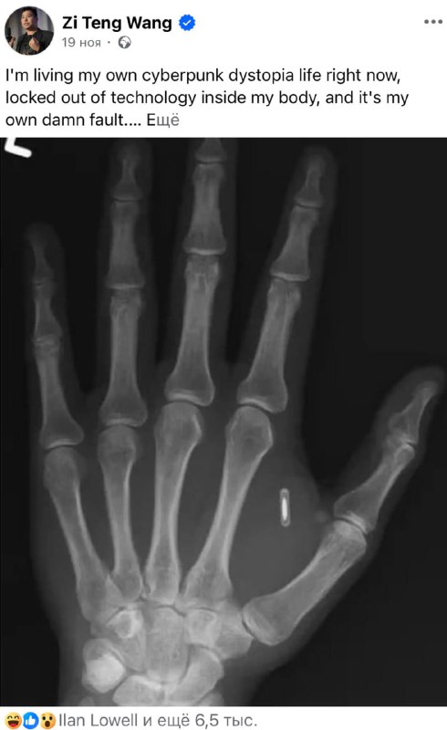 Чувак вживил себе чип в руку и забыл от него пароль.
Незадачливый киборг сначала флексил имплантом