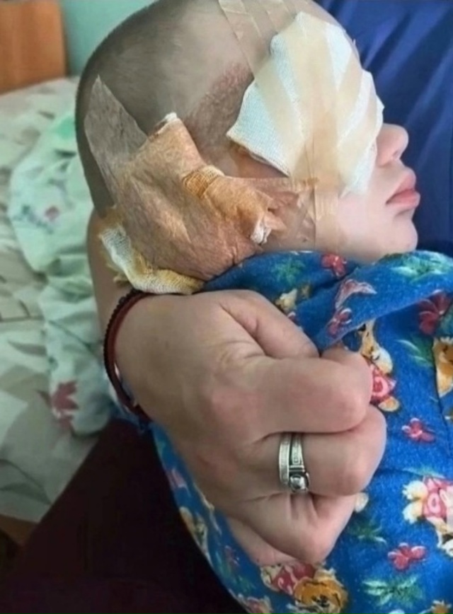 Мать пьяная изуродовала собственного ребёнка.
В одно...