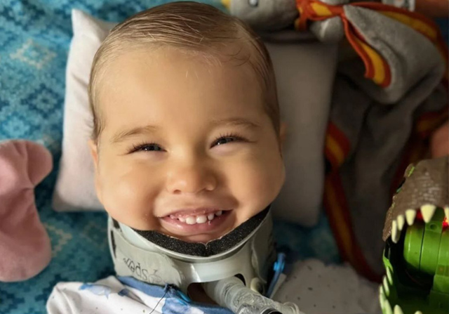 Ребёнку пришили голову к телу после жёсткого ДТП и он в...