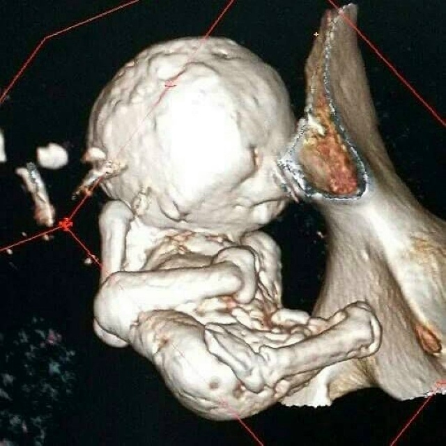 😱Когда 73-летняя женщина обратилась к врачам с жалобам...