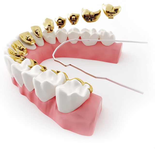 Бесплатно=Консультация+Осмотр+План лечения+КТ
Цены на ...