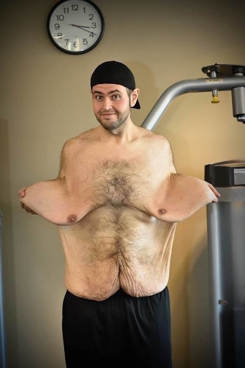 Джон Аллер, который в своё время весил 245 килограммов!!!