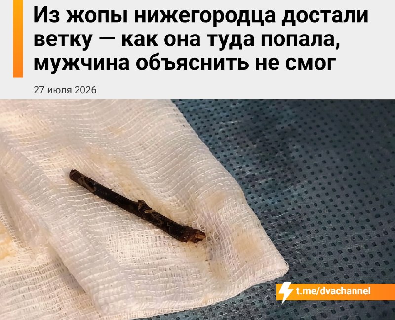 ❗️Из жопы нижегородца достали палку — как она туда попала, мужчина объяснить не смог
На приёме у пр