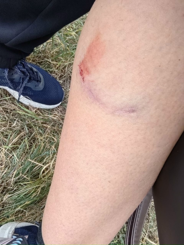 🐕 В Орске бездомная собака напала на беременную женщи...