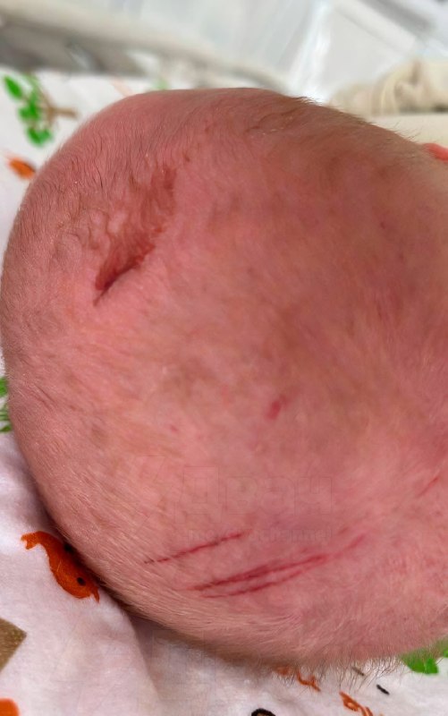 ❗️Девять погибших младенцев и больные врачи: в новокузнецком роддоме произошла лютая крипота.
Расск