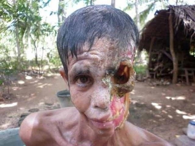 Одна из самых страшных болезней развивающихся стран –...