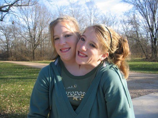 Сиамские близнецы вышли замуж. Точнее, одна из них😅
В ...