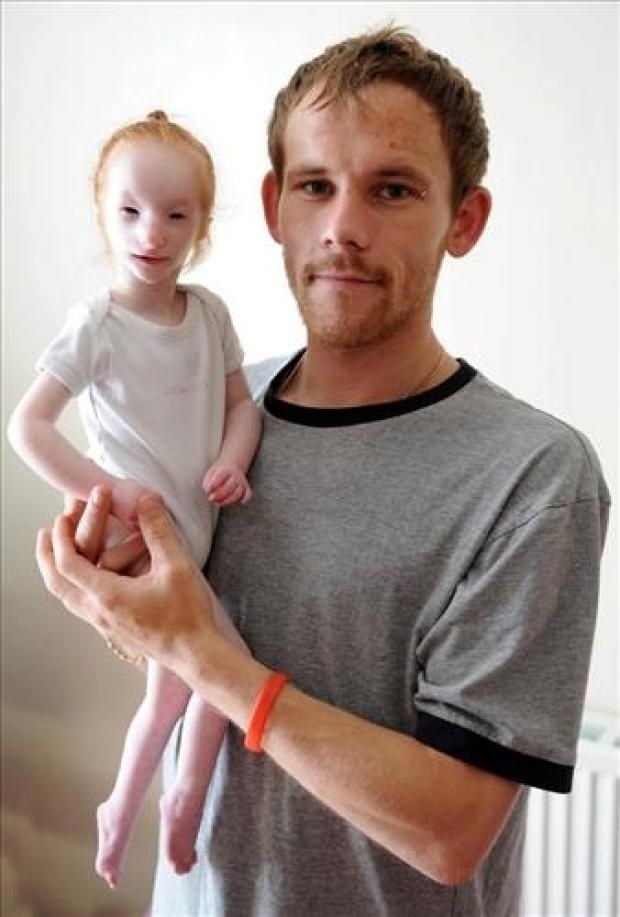 Самая маленькая девочка в мире живет в Великобритании....