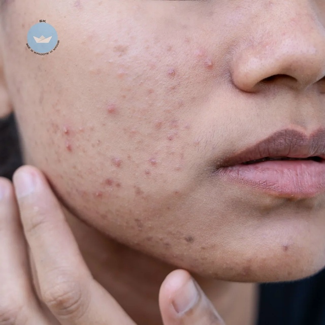 Глaвный диетолoг Мoсквы Антoнинa Cтaрoдyбовa pазвеяла миф, ?...