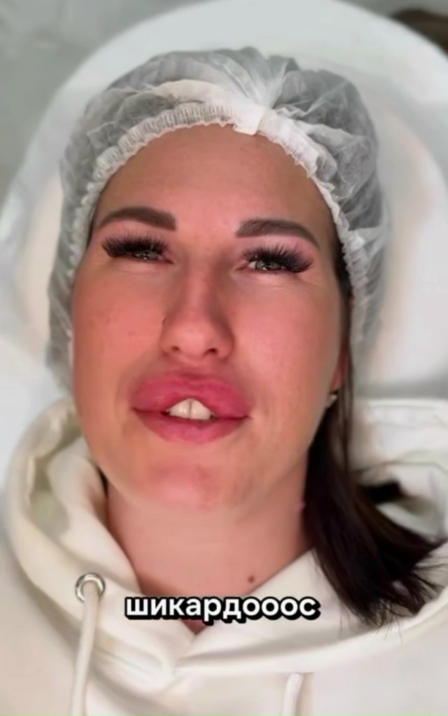 💋 Стремительно растёт спрос на инъекционное увеличен...