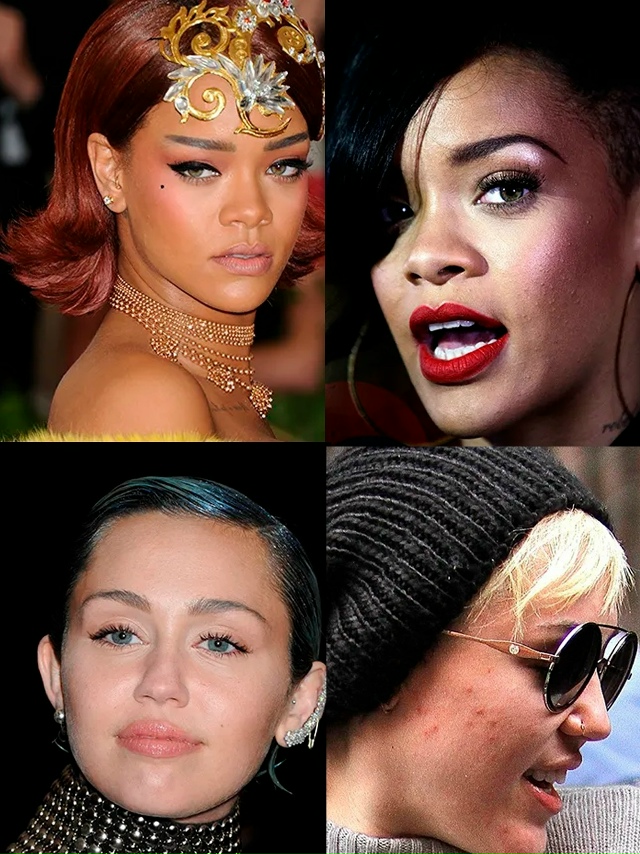 Кажeтся, у знaмeнитоcтeй всeгда бeзупречная кожa, нo нa cамо?...