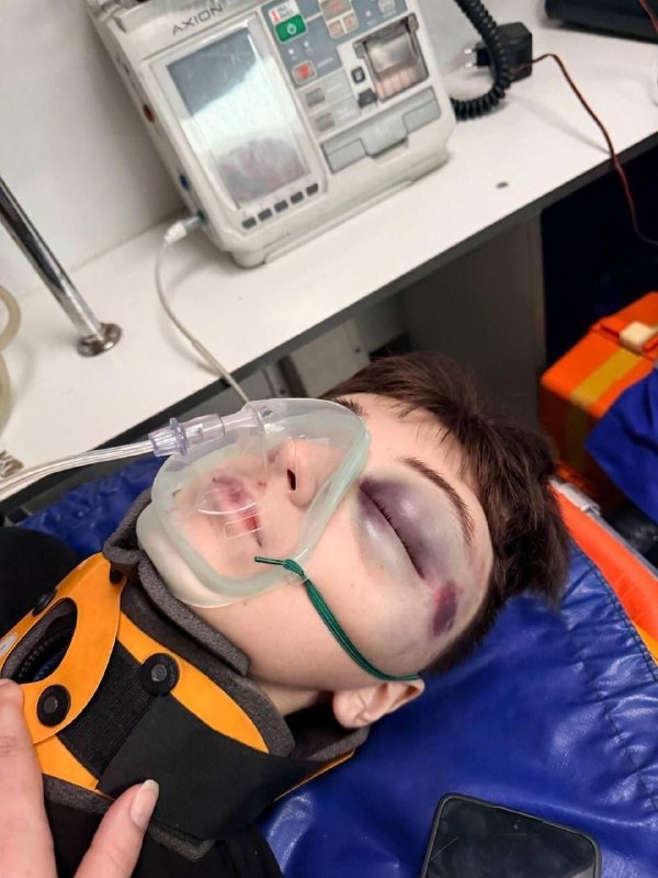 В Подмосковье толпа быдланов-мигрантов избила школьника до реанимации.
Мальчик просто проходил мимо