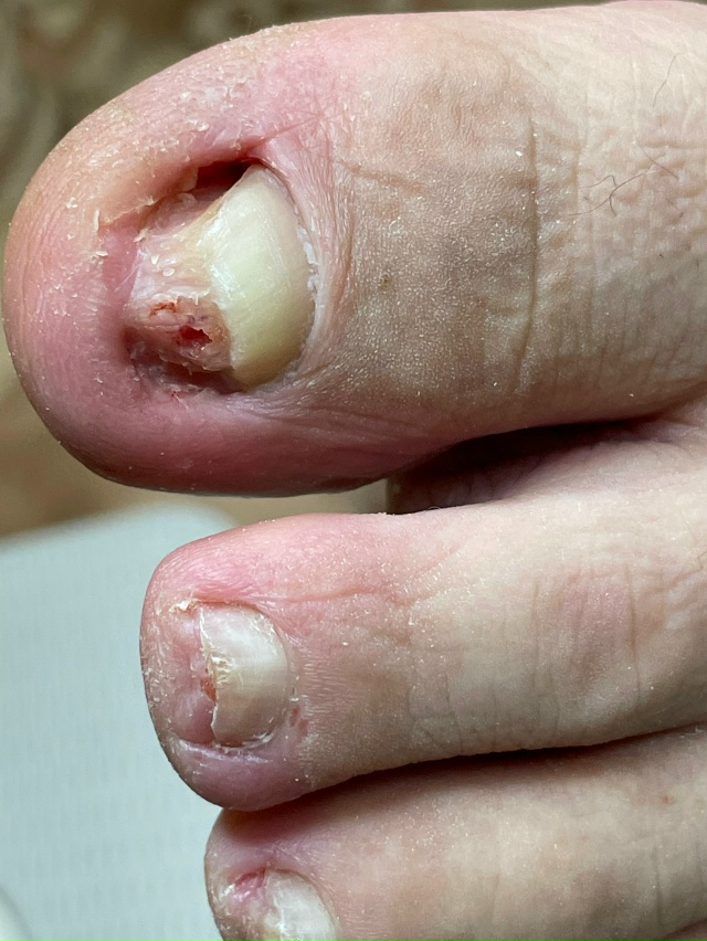 Добрый день!
С 14.11-16.11 ведет прием Нижегородский подоло?...