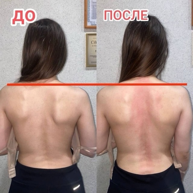 ✅ Орск, 16-17 августа
«Здоровый Стержень» принимает паци...