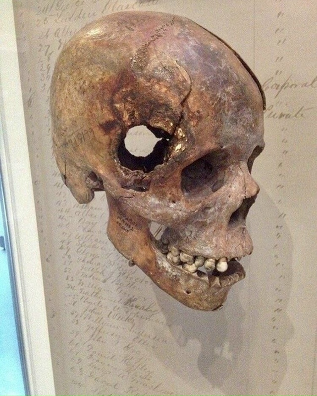 Чepeп солдата, убитого выстрелом картечью во время битв?...