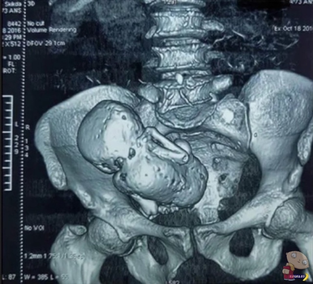 😱Когда 73-летняя женщина обратилась к врачам с жалобам...