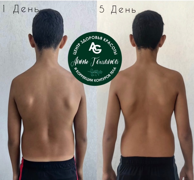 Массаж спины может значительно облегчить как острую, т...