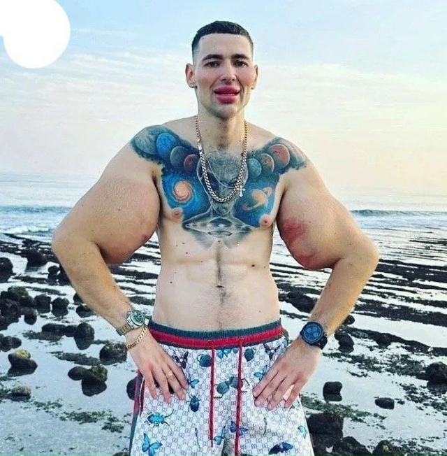 У 29-летнего Кирилла Терёшина начала гнить рука
В своё...