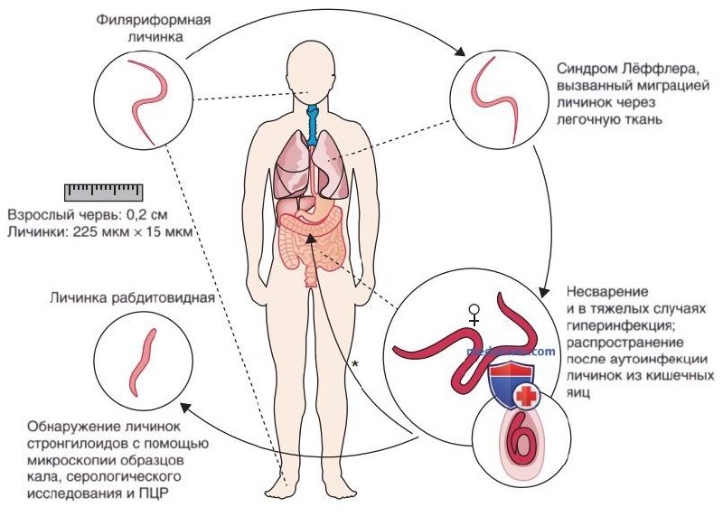 🦠 Каждый 10-й турист из тропиков может привезти «невидимого» паразита Strongyloides stercoralis, кот
