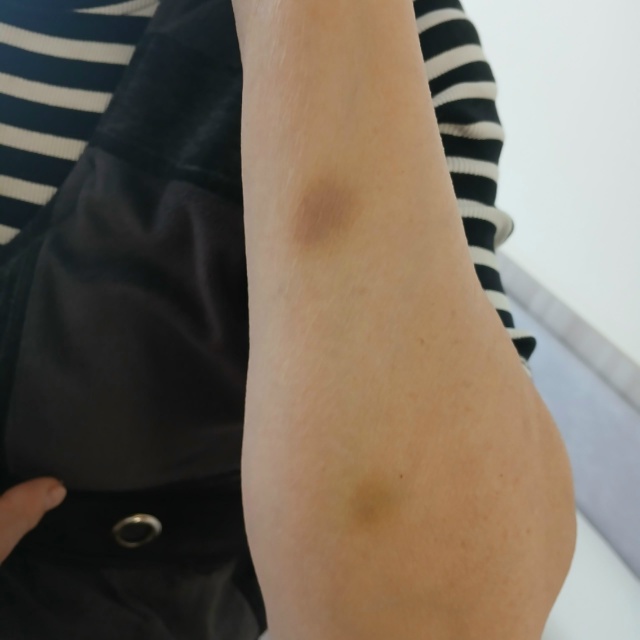 😰Вчера моя мама пострадала из-за темноты в посёлке Ст?...