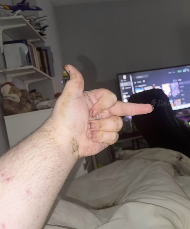 Один из лучших игроков по Fortnite — чухан, который буквально гниёт заживо
Игрун под ником TernsChe