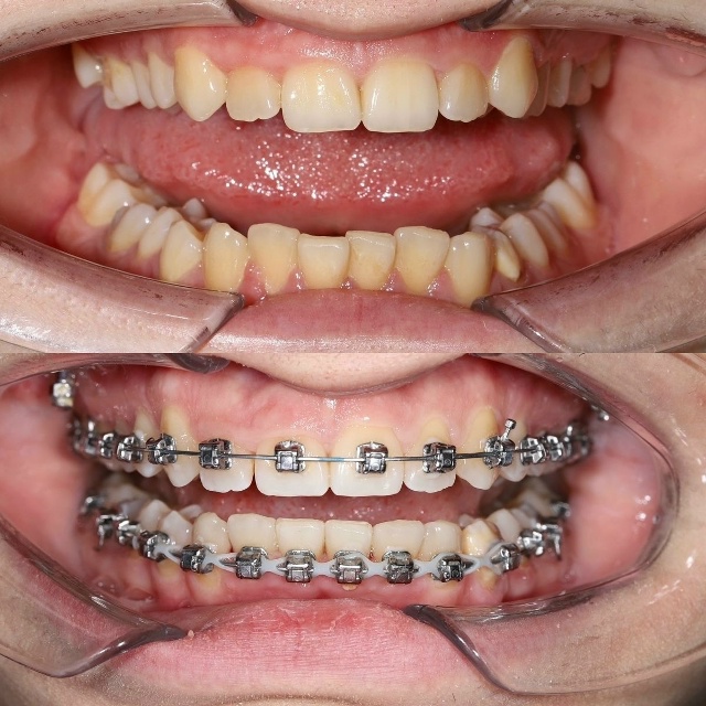 СТОМАТОЛОГИЯ Эмидент 📲 8-800-555-73-67 • stm.emident.ru
🏠 Стерлит...