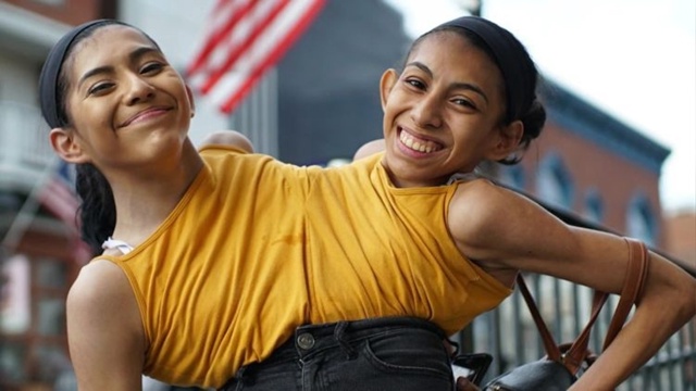 В США сестры - сиамские близнецы, 18-летние Кармен и Лупи...