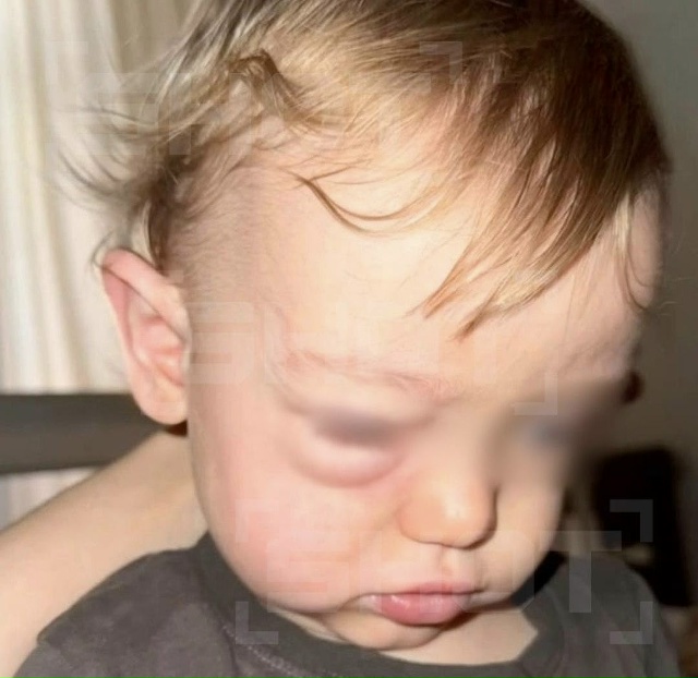 В Москве младенец едва не лишился зрения из-за промыва?...