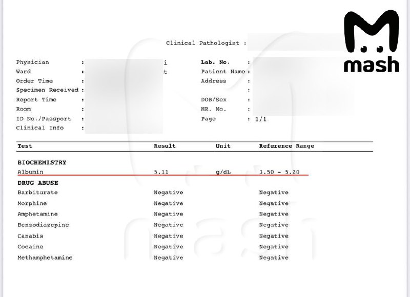 Российский турист умер на Бали от укуса ядовитой змеи, на которую не обратил внимания. Парень больше