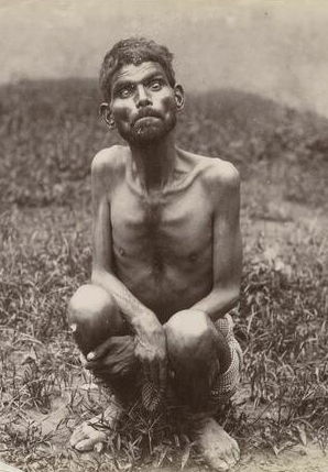 Дина Саничар жил в логове волков, его нашли в 1867 году. М?...