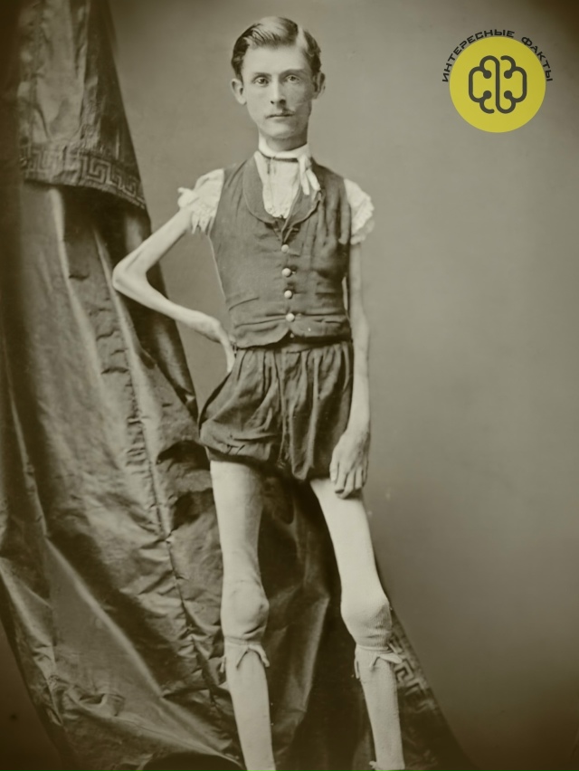 В 19 веке в Испании жил Бенито Альварадо — человек, кото...