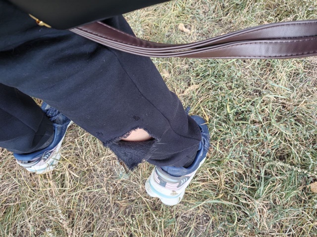 🐕 В Орске бездомная собака напала на беременную женщи...