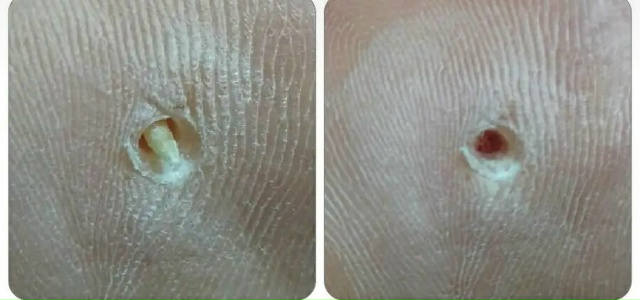 Специалист-подолог приглашает жителей Акбулака и близ...