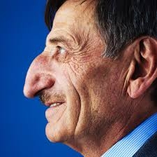 Самый длинный нос в мире – 8,8 см от лба до кончика – при...