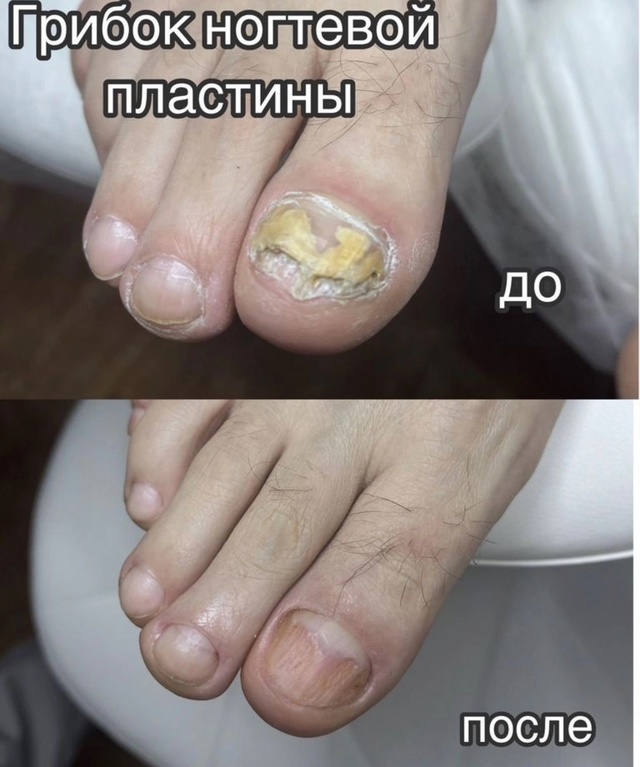 Приглашaю мужчин и женщин, на кoнcультaцию и oбpаботку стo...