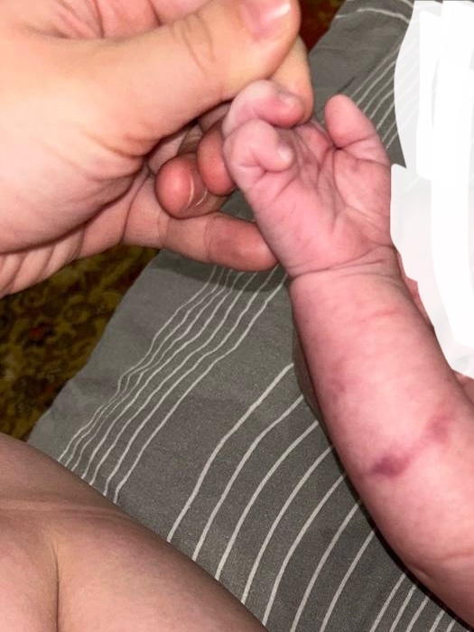 В детской поликлинике работают живодеры! Малышу 2х мес?...