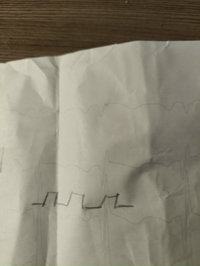 Анонимно.
Здравствуйте. Хочу попросить помощи у масте?...