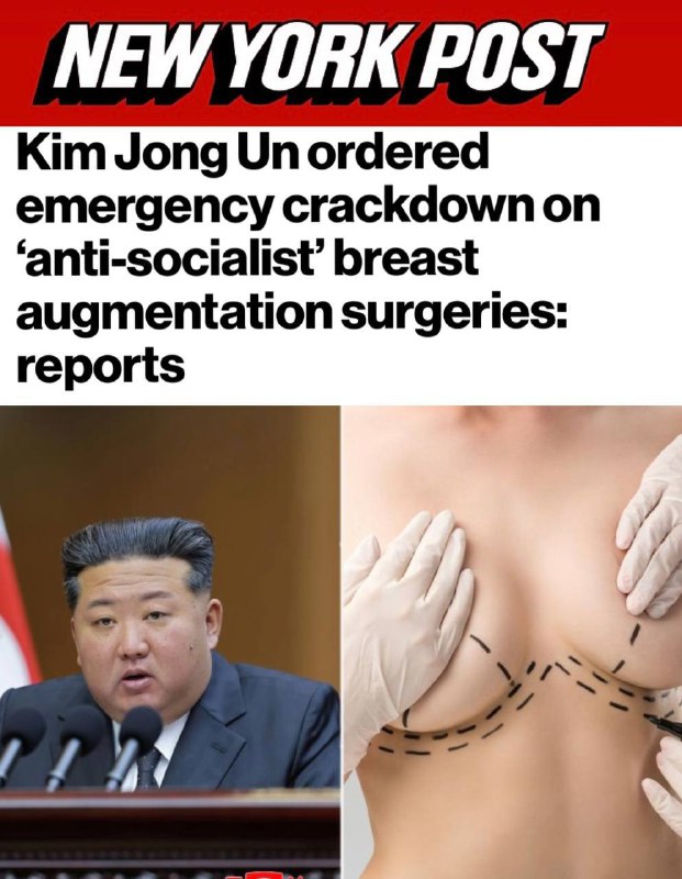 Ким Чен Ын запретил увеличение груди в Северной Корее, назвав операции антисоциалистическими, а импл