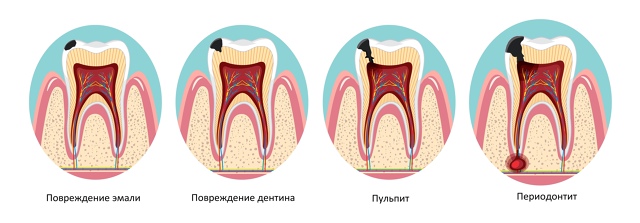 Бесплатно=Консультация+Осмотр+План лечения+КТ
Цены на ...