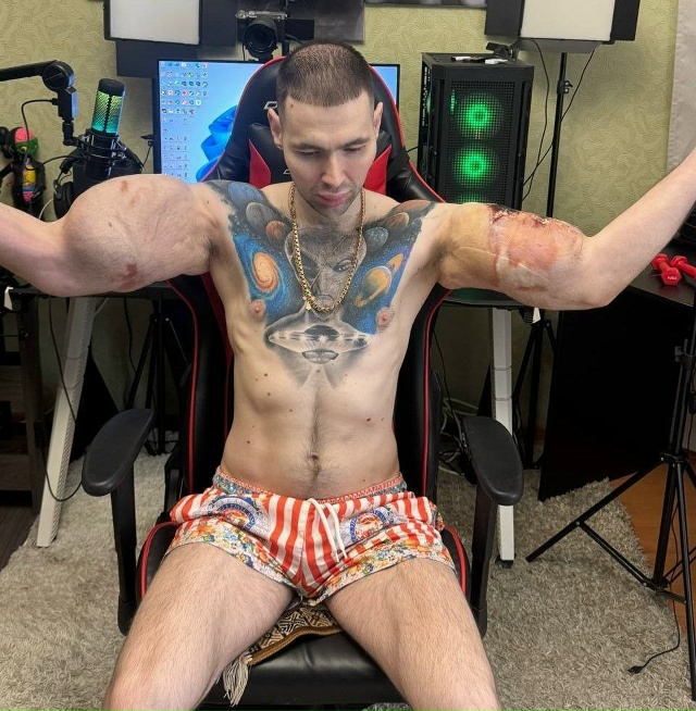 ☠️ Закачавшему в руки синтол треш-блогеру Руки-Базуки...